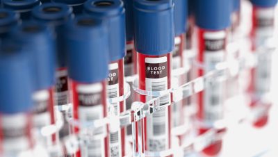 Tube and vial labeling made easier with automated label application.