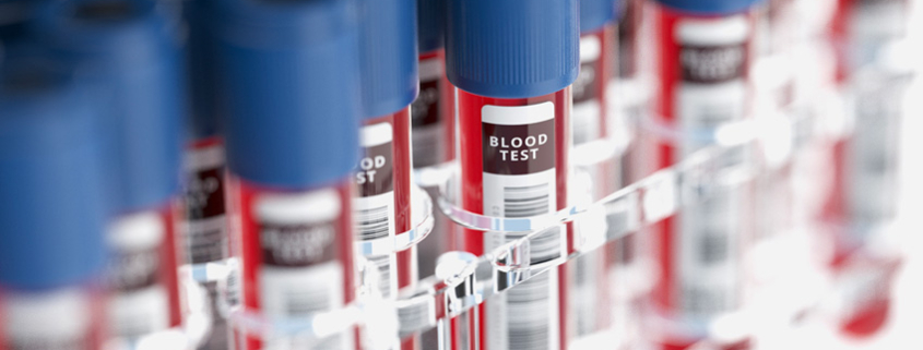 Tube and vial labeling made easier with automated label application.